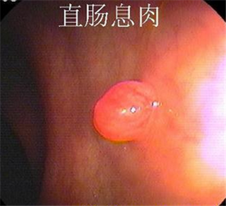 阜阳兆岐肛肠医院 阜阳兆岐肛肠医院