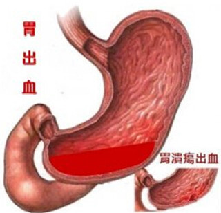 阜阳兆岐肛肠医院 阜阳兆岐肛肠医院