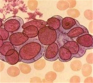 阜阳兆岐肛肠医院 阜阳兆岐肛肠医院