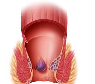 阜阳兆岐肛肠医院 阜阳兆岐肛肠医院