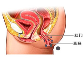 阜阳兆岐肛肠医院 阜阳兆岐肛肠医院