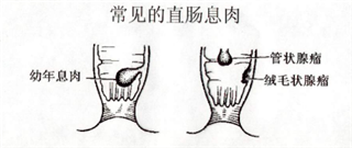 阜阳兆岐肛肠医院 阜阳兆岐肛肠医院